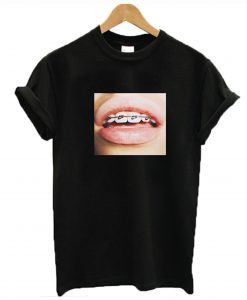 Braces Teeth T-Shirt (GPMU)